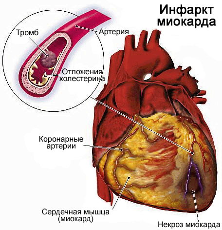 Учащенное сердцебиение болит левая грудь thumbnail